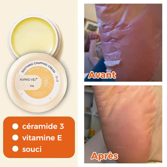 Crema antidesgarro para pieles resecas